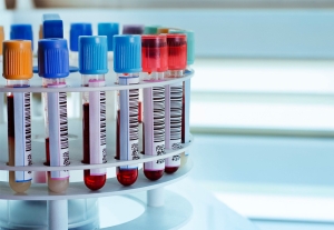 Диспансеризация-2026 — какие обследования помогут выявить онкологию на ранней стадии